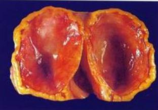 6205345905_d59a564256-160x160