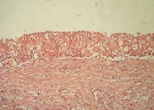 6205345905_d59a564256-160x160