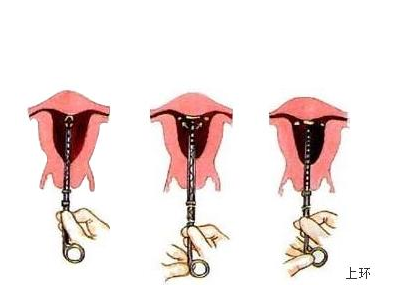 6205345905_d59a564256-160x160